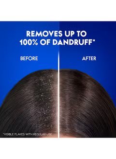 Charcoal Detox Anti-Dandruff Shampoo 400ml - Image 2