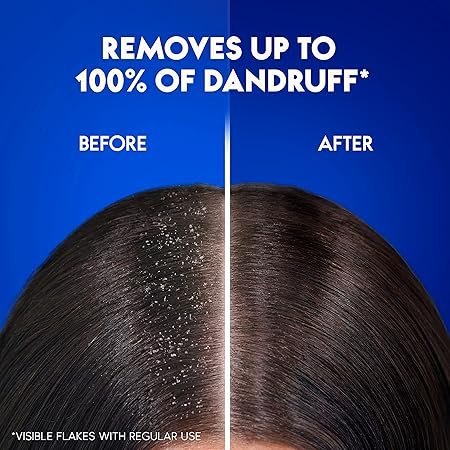 Head & Shoulders Menthol Refresh Anti-Dandruff Shampoo for a Cool and Energized Scalp, 1 L - Image 2